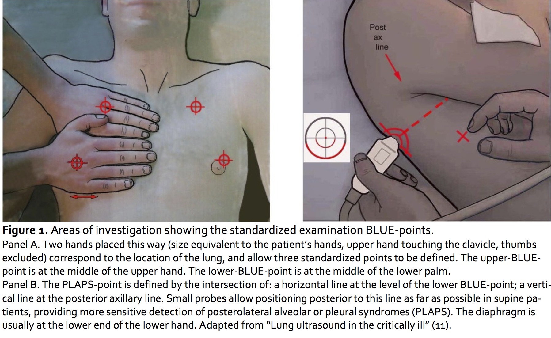 Figure1