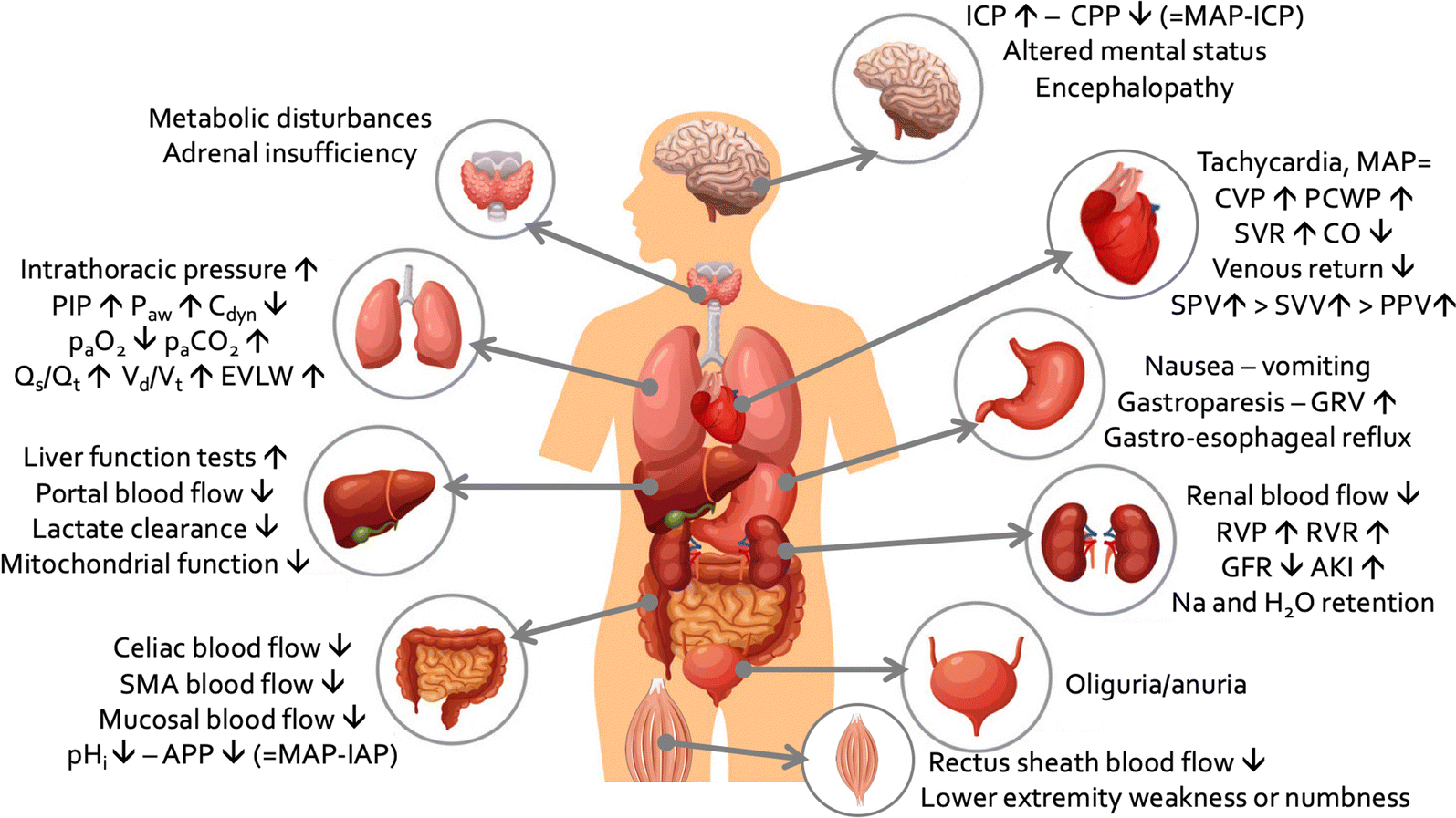 Ventilation in patients with intra-abdominal hypertension