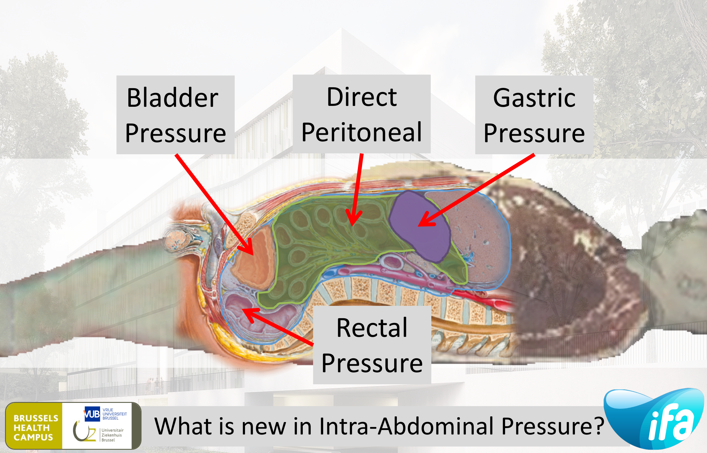 What is new in IAP measurement (#IFAD2018 #iFADmini)