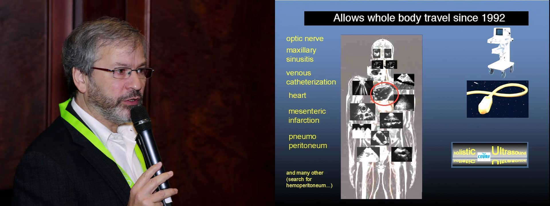 Hands-on Session: Lung