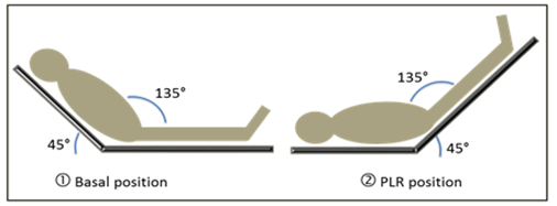 The hypotensive oedematous septic patient