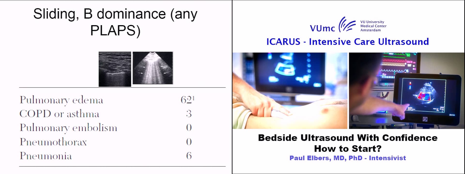 How to consolidate US in your unit